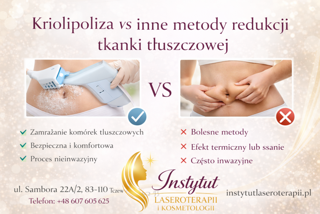 Kriolipoliza vs inne metody redukcji tkanki tłuszczowej