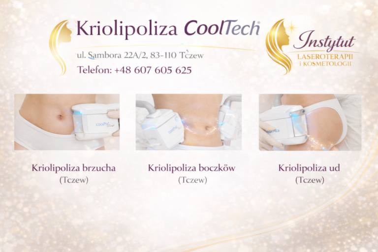 Kriolipoliza CoolTech Tczew – Skuteczne Zamrażanie Tkanki Tłuszczowej